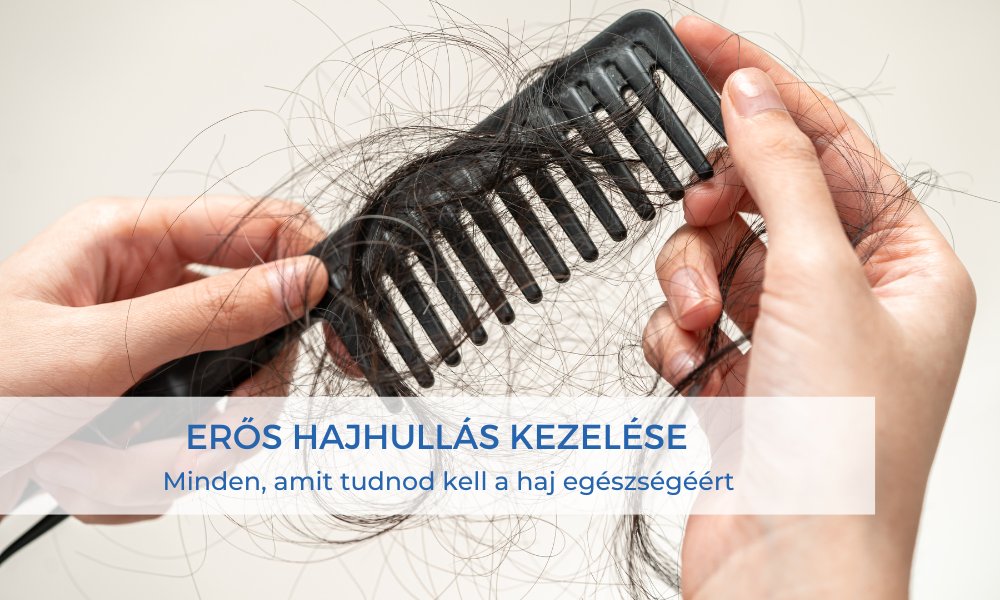 erős hajhullás kezelése